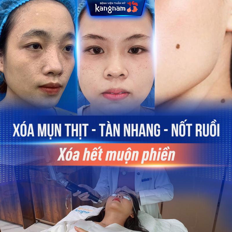 Bệnh viện Thẩm mỹ Kangnam