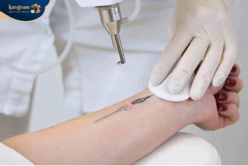 Bệnh viện thẩm mỹ Kangnam