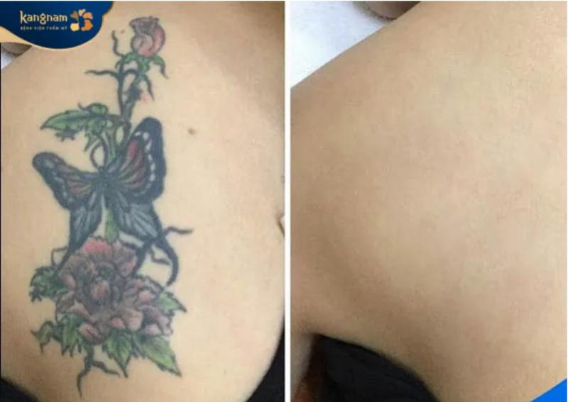 Bệnh viện thẩm mỹ Kangnam