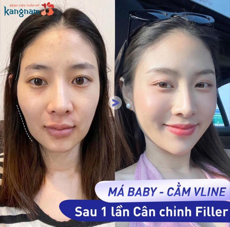 Bệnh viện thẩm mỹ Kangnam