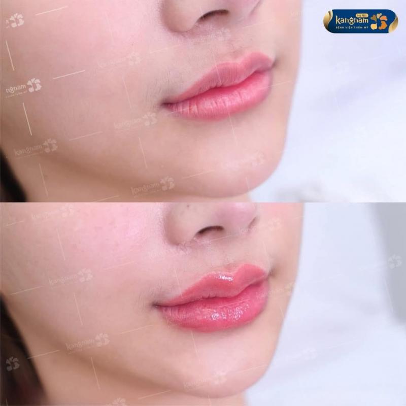 Bệnh viện thẩm mỹ Kangnam