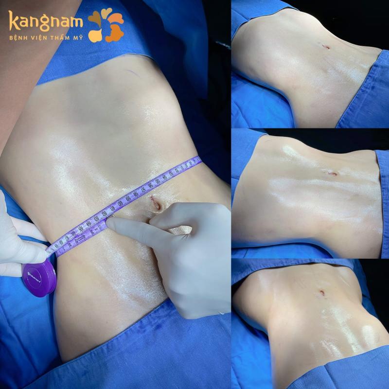 Bệnh viện thẩm mỹ Kangnam