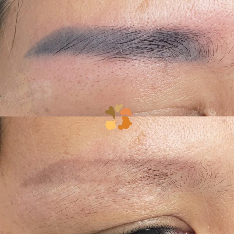 Bệnh viện thẩm mỹ Kangnam