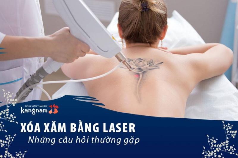 Xóa hình xăm uy tín với công nghệ Laser Toning Plus