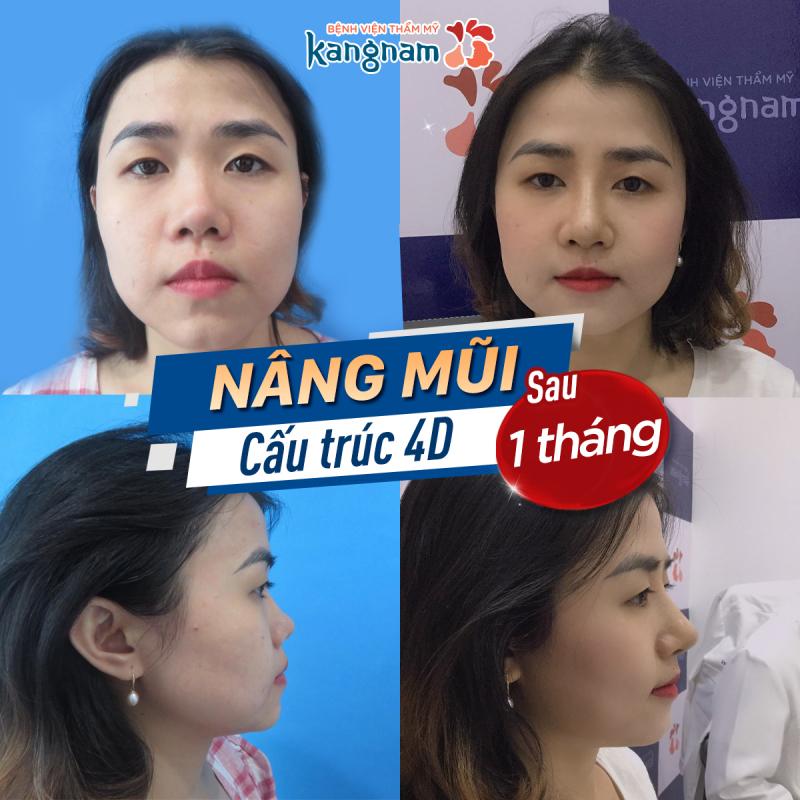 Bệnh viện Thẩm mỹ Kangnam