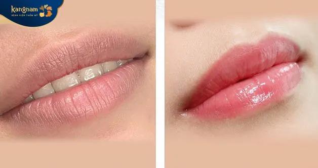 Bệnh viện thẩm mỹ Kangnam Hà Nội