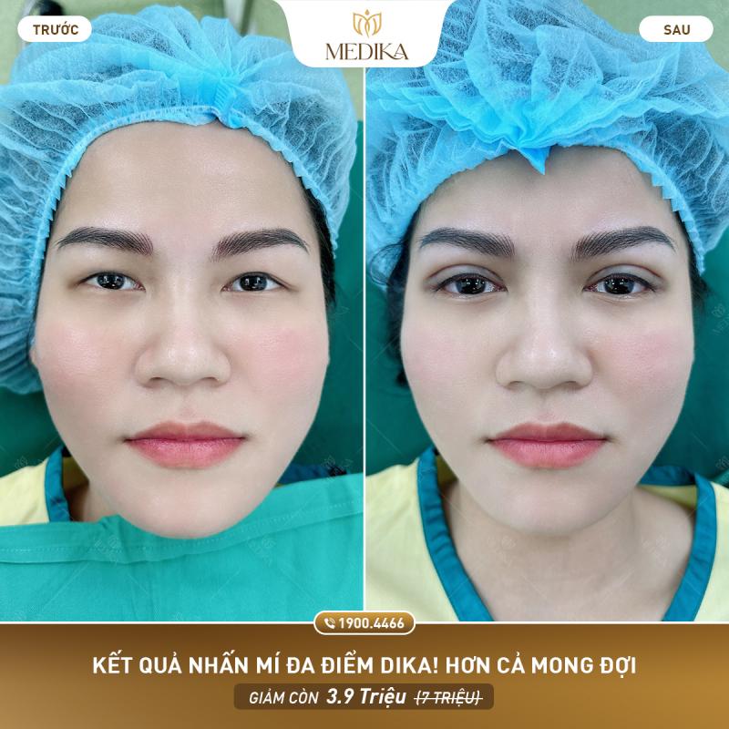 Bệnh viện thẩm mỹ Medika