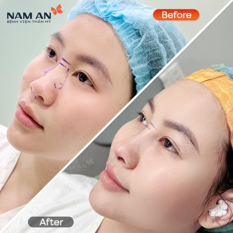 Bệnh viện thẩm mỹ Nam An