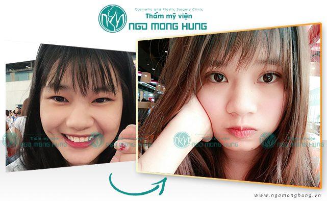 Bệnh viện thẩm mỹ Ngô Mộng Hùng