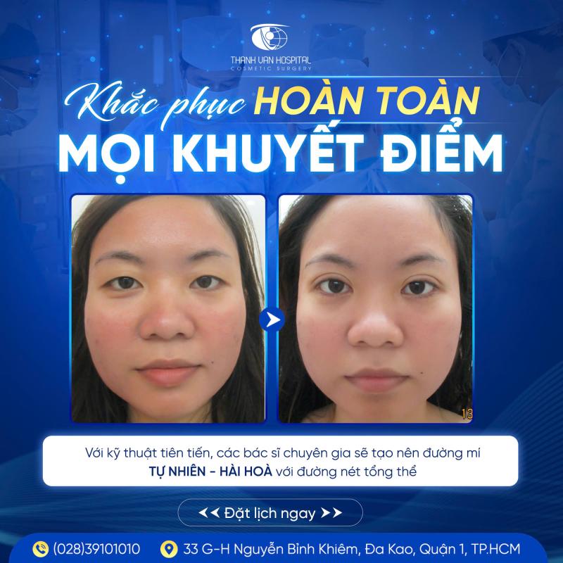 Bệnh Viện Thẩm Mỹ Thanh Vân