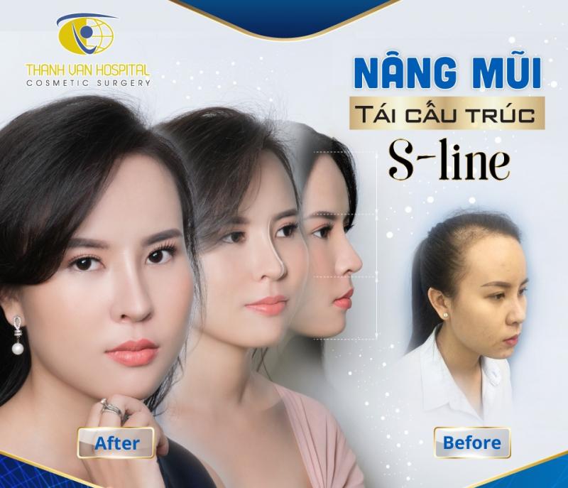 Bệnh Viện Thẩm Mỹ Thanh Vân