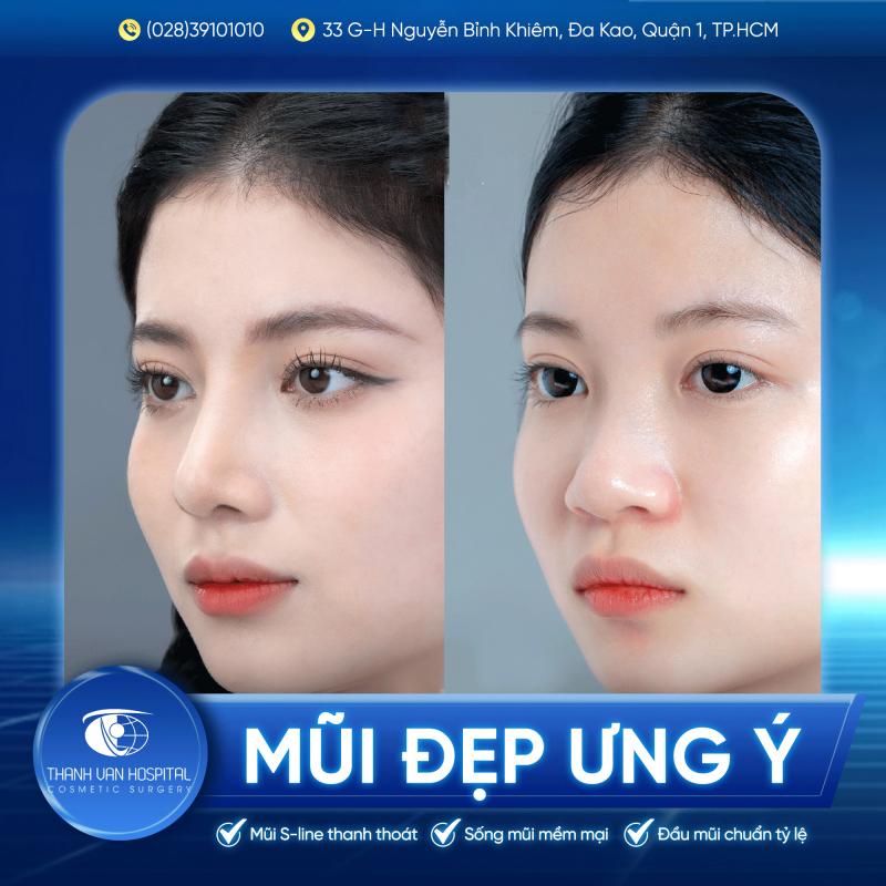 Bệnh Viện Thẩm Mỹ Thanh Vân