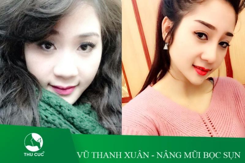 Bệnh viện thẩm mỹ Thu Cúc