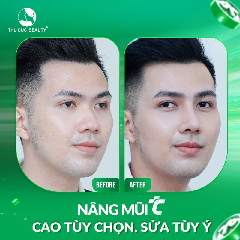 Bệnh viện thẩm mỹ Thu Cúc