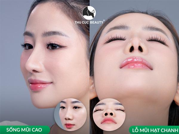 Thẩm mỹ Thu Cúc