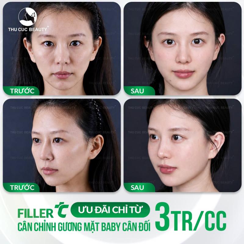 Bệnh Viện Thẩm Mỹ Thu Cúc
