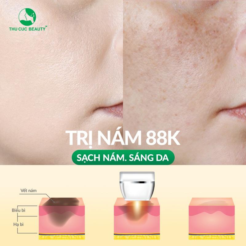 Bệnh Viện Thẩm Mỹ Thu Cúc Hà Nội