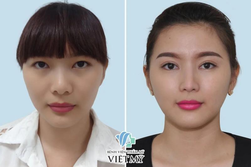 Bệnh viện thẩm mỹ Việt Mỹ