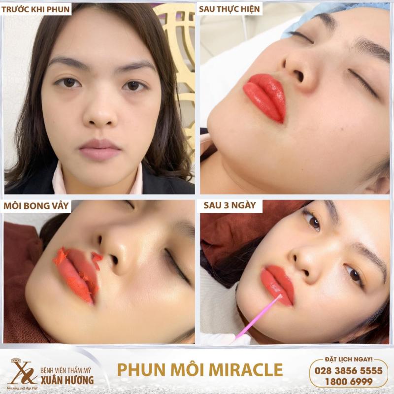 Bệnh Viện Thẩm Mỹ Xuân Hương