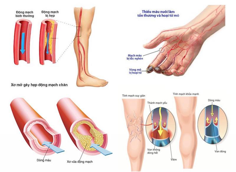 Bệnh viện Tim Hà Nội