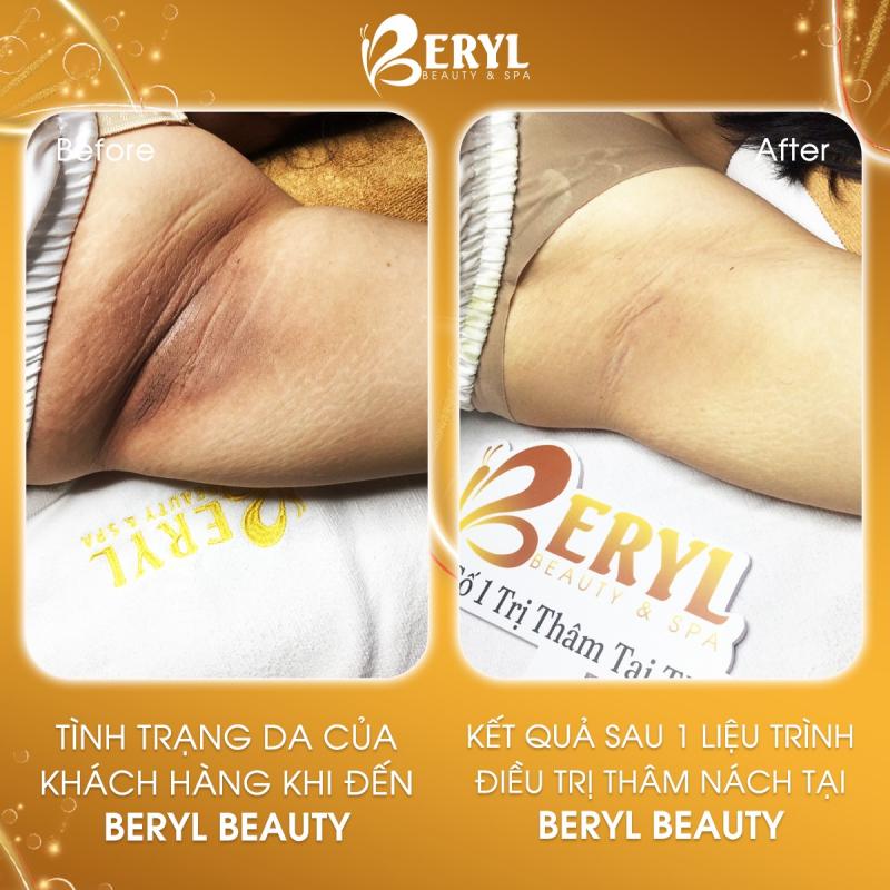 Beryl Beauty & Spa