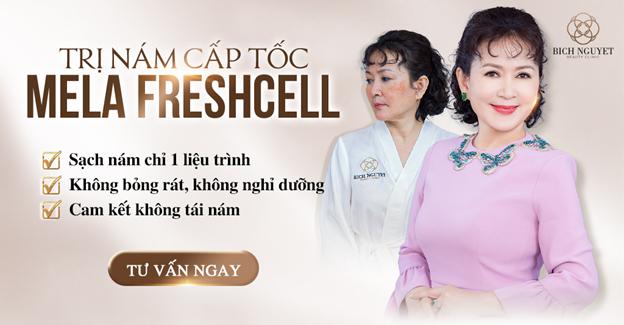 Trị Nám Thẩm Mỹ Bích Nguyệt