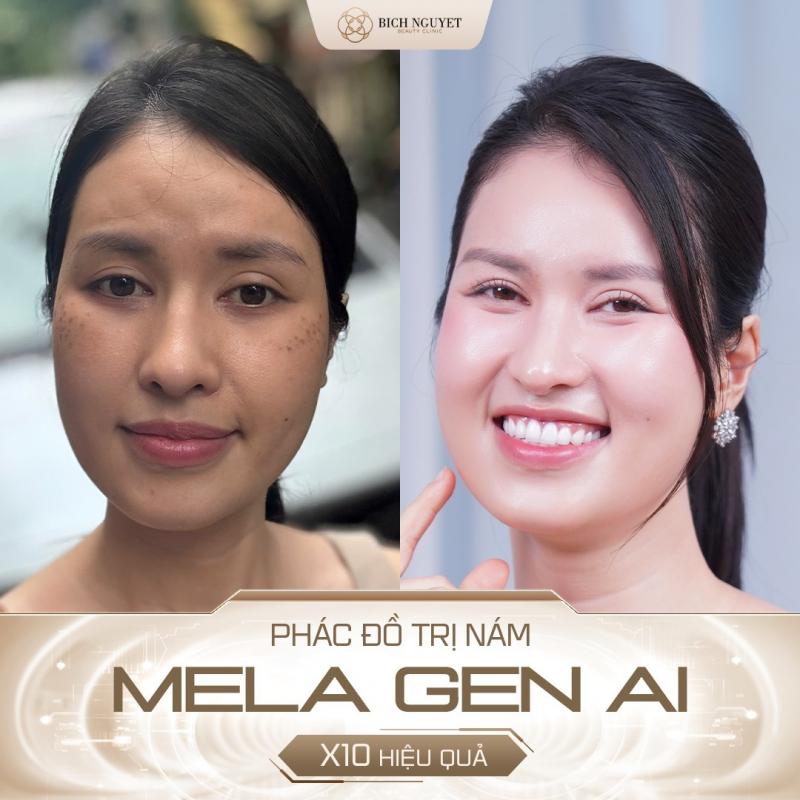 Bích Nguyệt Beauty Clinic