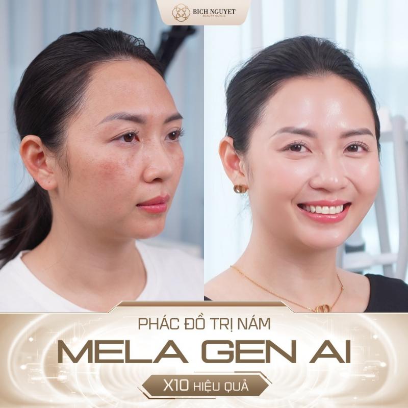 Bích Nguyệt Beauty Clinic