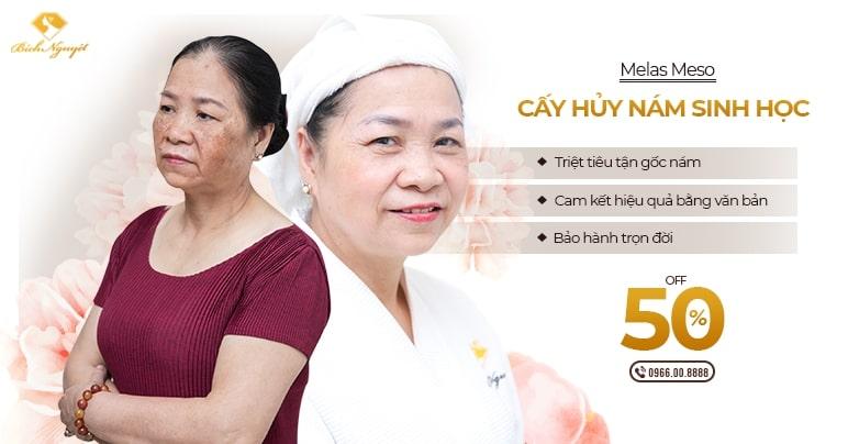 Top 9 Spa Trị Nám Hiệu Quả Nhất Quận Hai Bà Trưng, Hà Nội - Toplist.vn