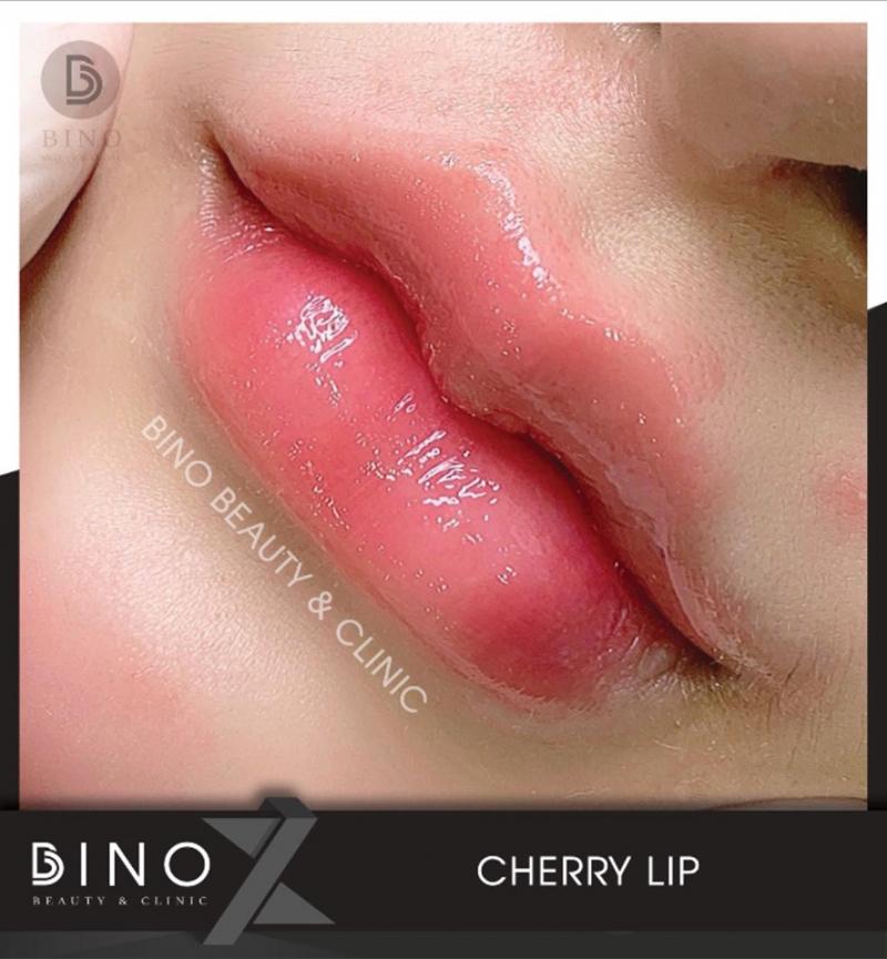 Bino Beauty & Clinic