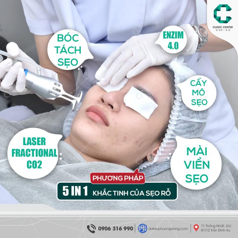 C Spa & Clinic - Trị Sẹo Rỗ