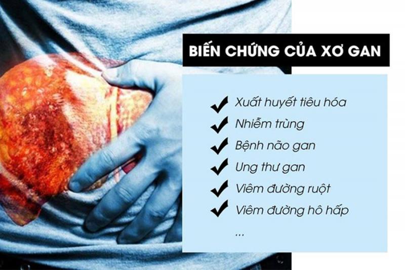 Các biến chứng của xơ gan