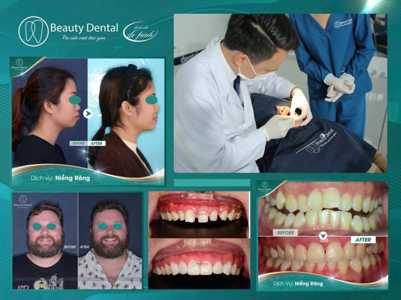 Khách hàng trong và ngoài nước lựa chọn Beauty Dental vì sự an tâm và chất lượng điều trị