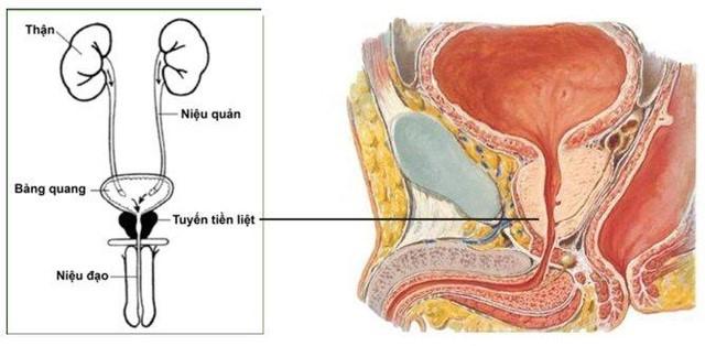 Ung thư tuyến tiền liệt là gì?