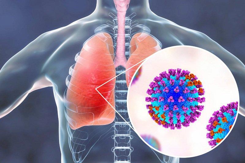 Adenovirus gây bệnh viêm phổi