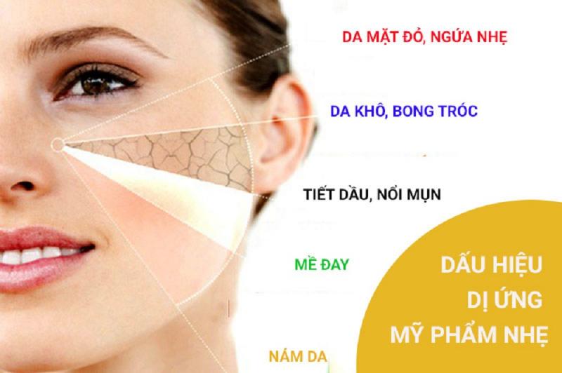 Dấu hiệu khi da mặt dị ứng mỹ phẩm