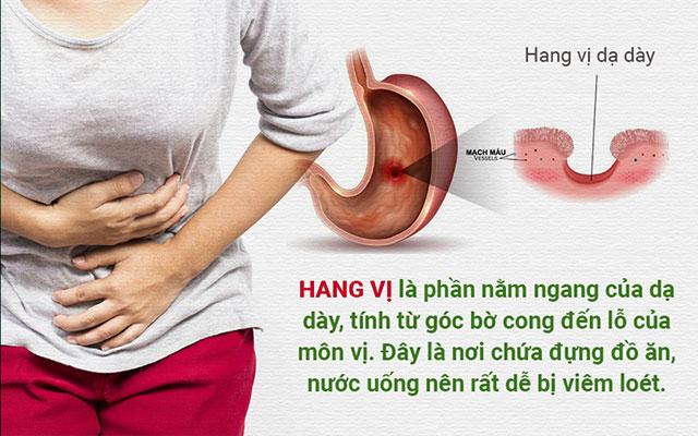 Cam thảo dây chữa viêm hang vị dạ dày