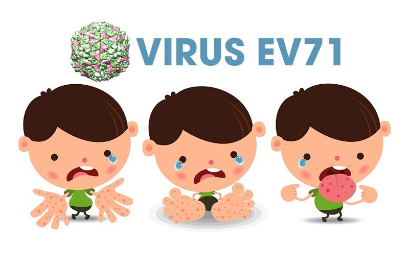 Virus EV 71 dễ gây nhiều biến chứng nguy hiểm cho trẻ như viêm não – màng não, viêm cơ tim, phù phổi cấp dẫn đến tử vong nên người bệnh cần được phát hiện sớm, điều trị kịp thời