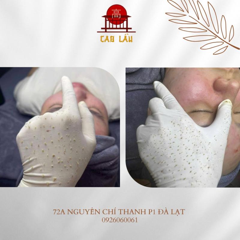 Cao Lầu Spa & Clinic