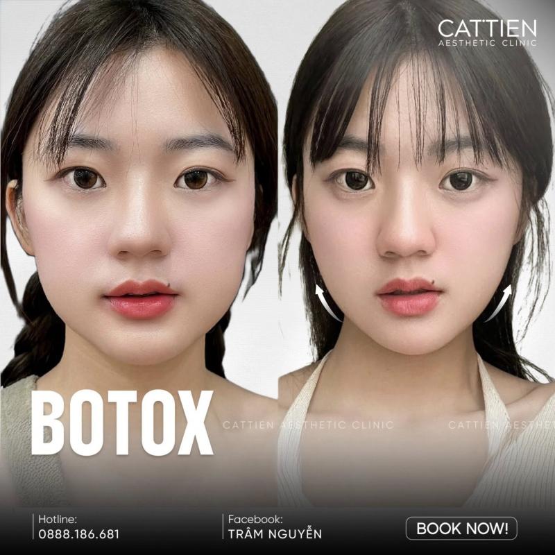 CÁT TIÊN Aesthetic Clinic