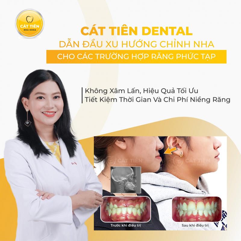 Cát Tiên Dental