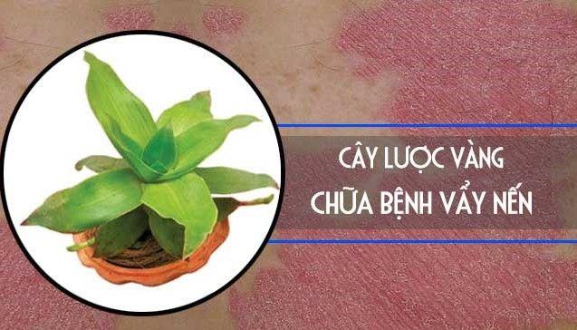 Chữa vảy nến hiệu quả bằng cây lược vàng