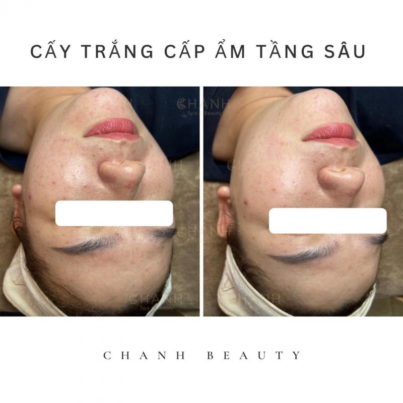 CHANH Spa & Beauty