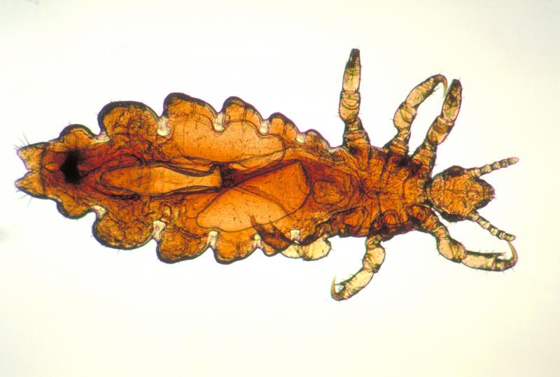 Chấy Pediculus humanus capitis