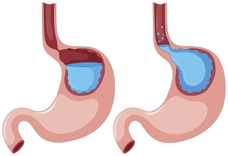 Chỉ định và chống chỉ định của Maldiv