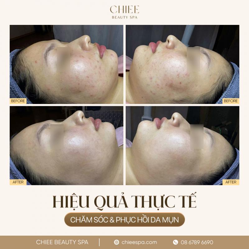 CHIEE Beauty Spa Thủ Đức