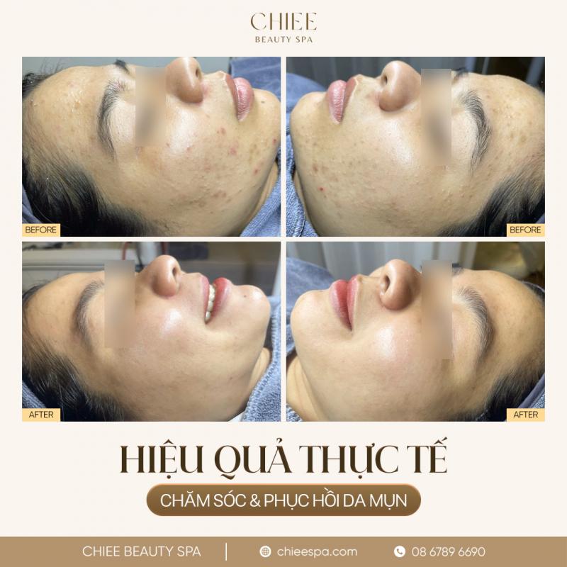CHIEE Beauty Spa Thủ Đức