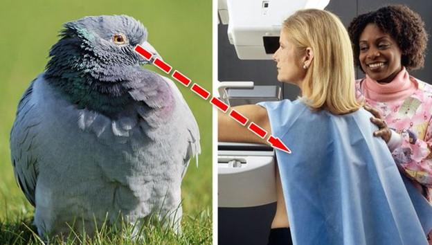 Chim bồ câu có thể xác định ung thư vú trong chụp quang tuyến vú