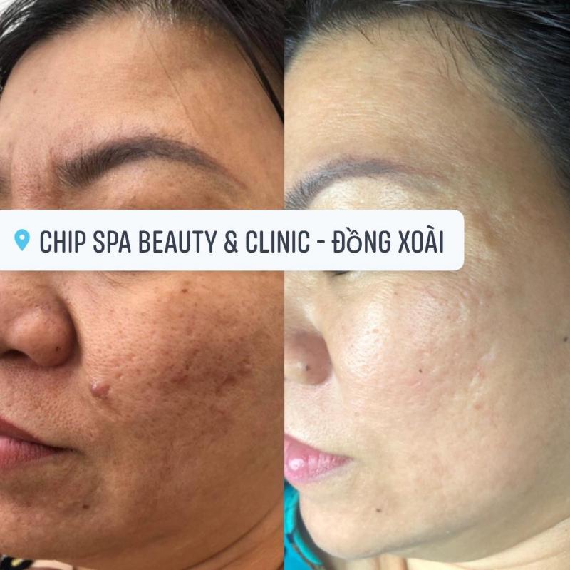 Chip Spa Beauty & Clinic