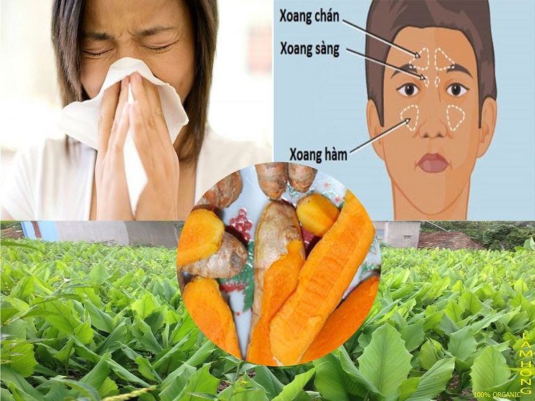 Chữa viêm mũi dị ứng bằng nghệ tươi hay bột nghệ